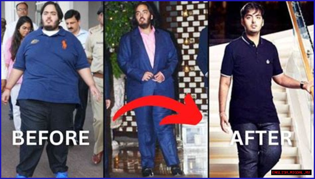 Anant Ambani's Journey: Battling A Rare Disease With Courage